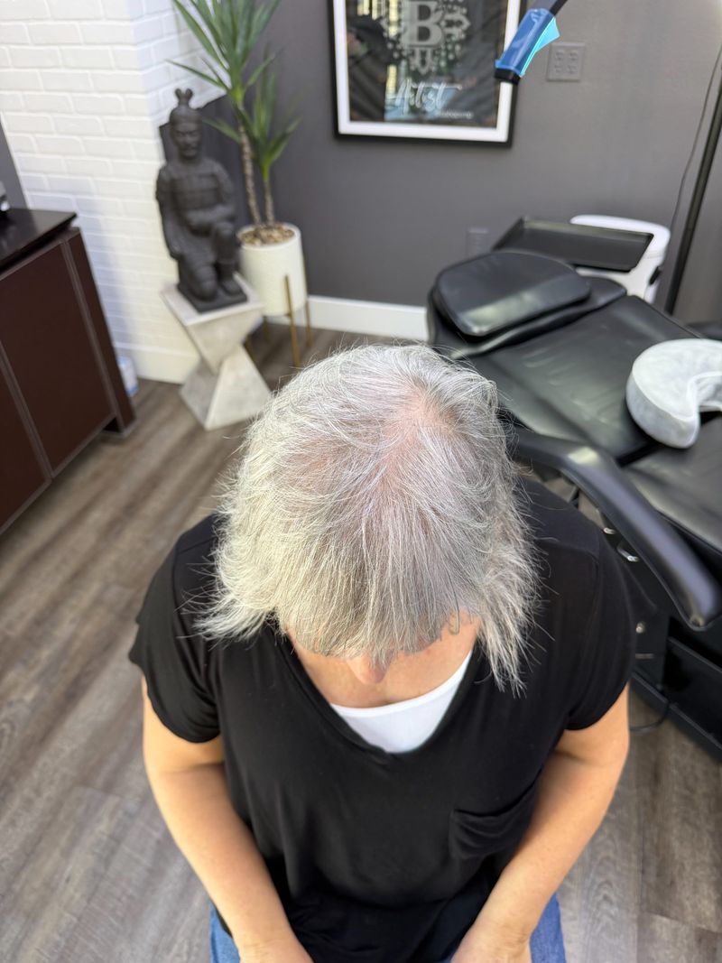 Debbie Before